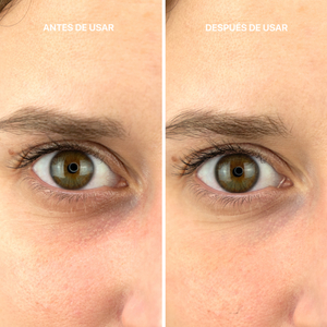 BOTOX EYE LIFT CONTOUR sérum